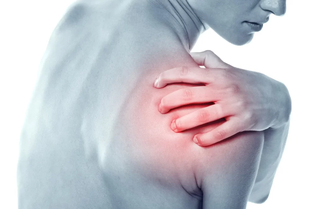 ¿Qué es un hombro congelado o capsulitis adhesiva?